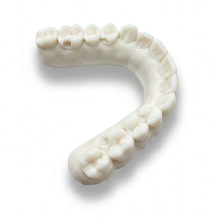 A white dental mold or temporary tooth tray shaped like a curved arch of teeth, resting on a person's palm.