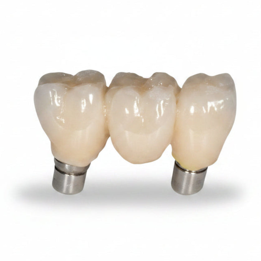 3Dresyn IJ OD C&B – Inkjet Photopolymer for Provisional Dental Laboratory Restorative Components