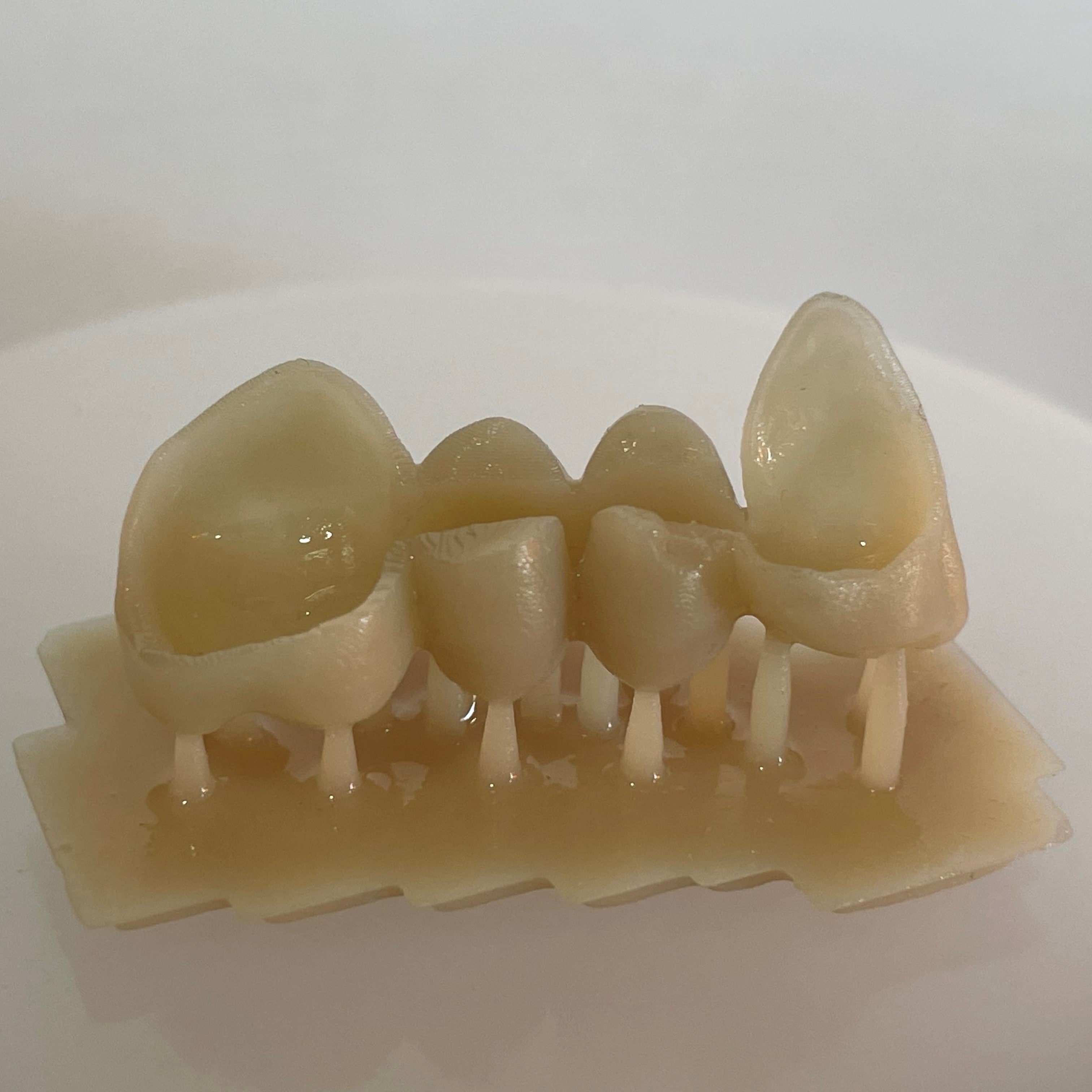 3Dresyn OD C&B MF for printing durable Crowns & Bridges and fixed veneers with Vita colors