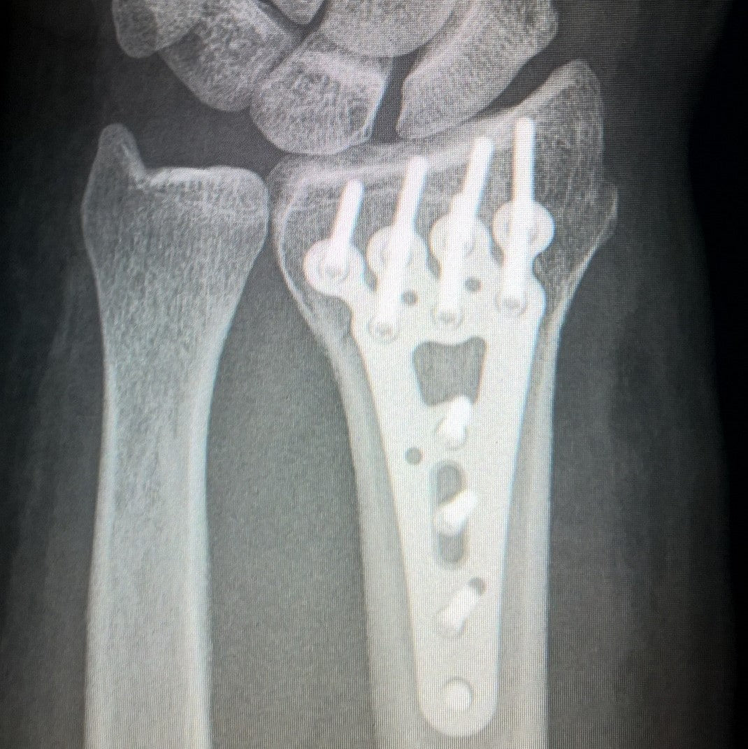 Metal Slurry MS Ti1 Titanium