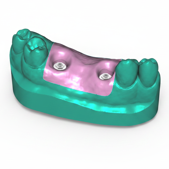 3Dresyn OD-S Soft Gingiva Mask Resin (view 2)