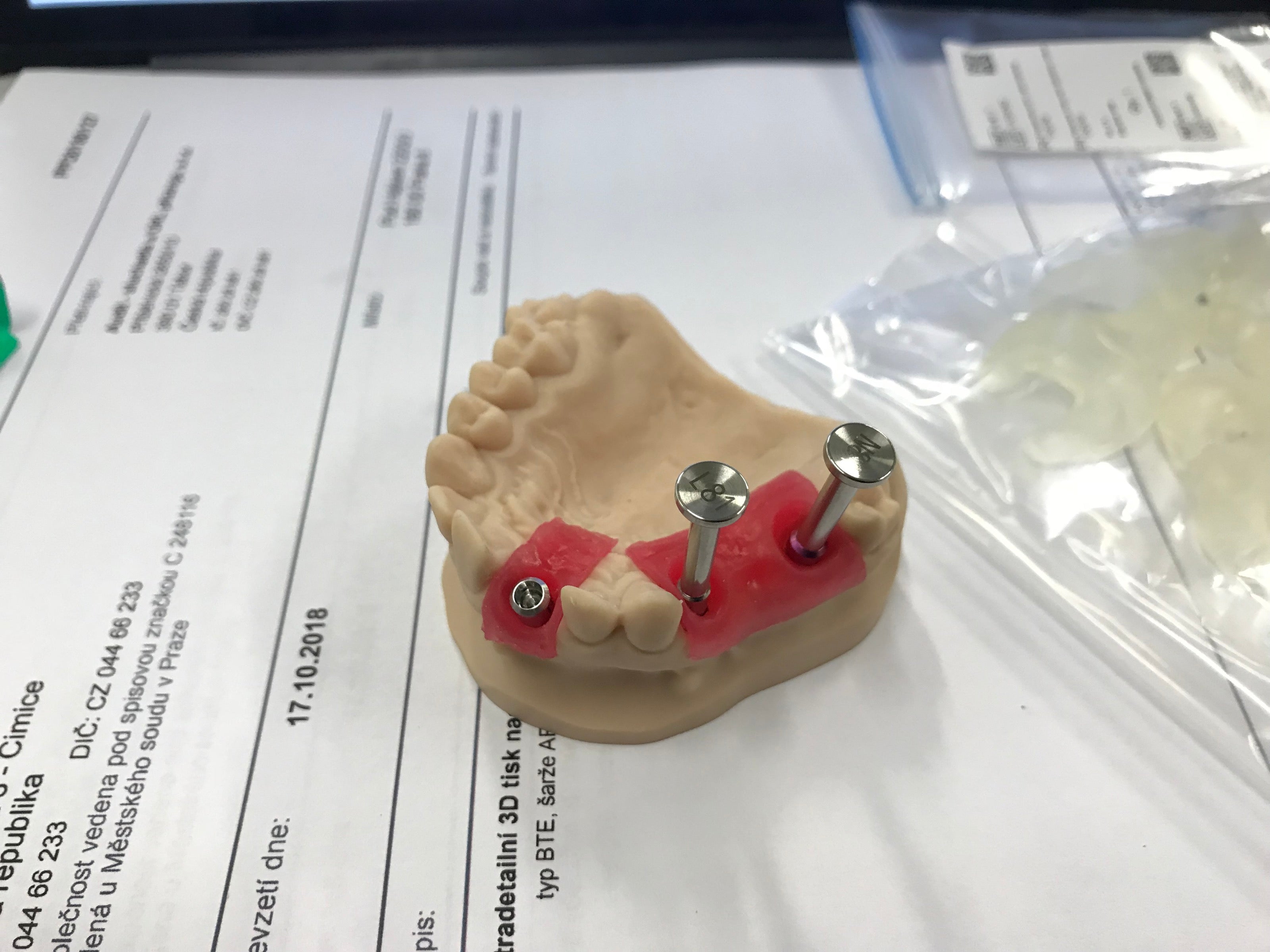 3Dresyn OD S Soft, pink gingiva color for printing gingiva masks on implant models