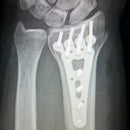 Metal Slurry MS Ti1 Titanium