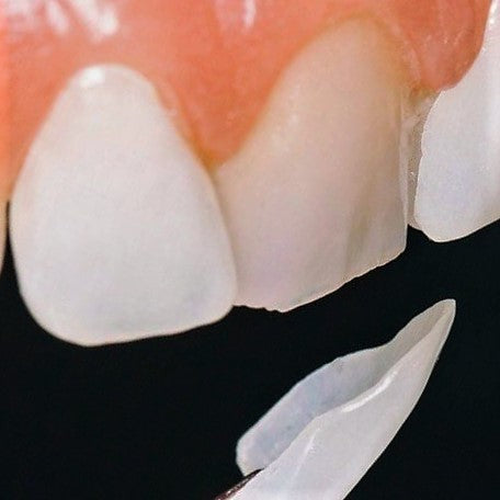 3D Cement OCA, Light Curable Opaque Cement Composite & Adhesive in Tooth colors A1-4, B1-4, C1-4, D2-4 & Bleach BL1