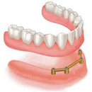 3D Adhesive HTA1 MF Bio, Hard & Tough Adhesive, Monomer Free Biocompatible